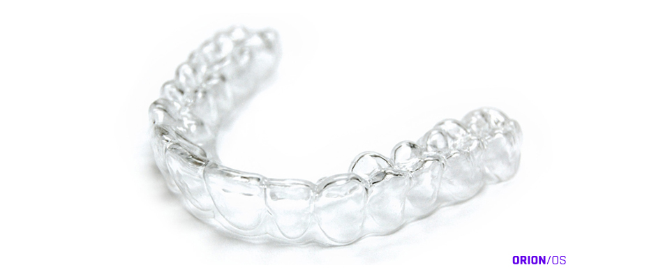 Patient wearing clear aligners